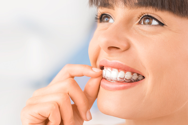 Invisalign in Draper